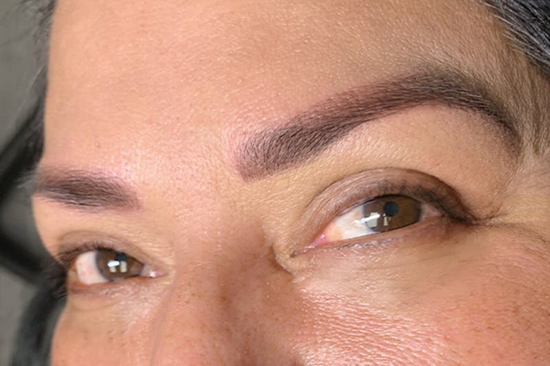 3D Microblading/ Henna Brows Before & After Gallery - Patient 93899677 - Image 2