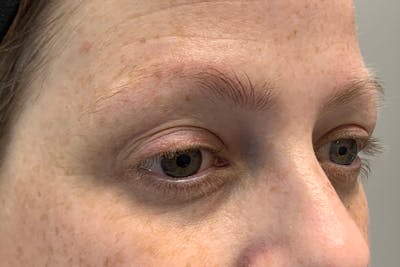 3D Microblading/ Henna Brows Before & After Gallery - Patient 93899723 - Image 1