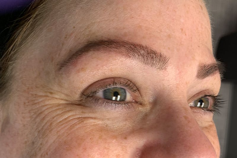 3D Microblading/ Henna Brows Before & After Gallery - Patient 93899723 - Image 2