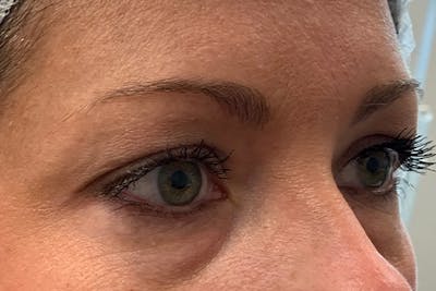 3D Microblading/ Henna Brows Before & After Gallery - Patient 93899727 - Image 1