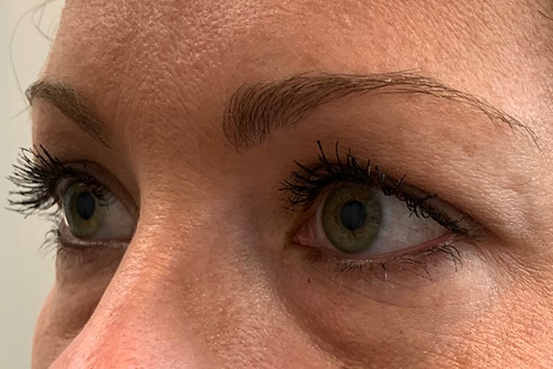 3D Microblading/ Henna Brows Before & After Gallery - Patient 93899727 - Image 3