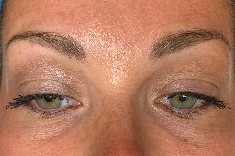 3D Microblading/ Henna Brows Before & After Gallery - Patient 93899727 - Image 5