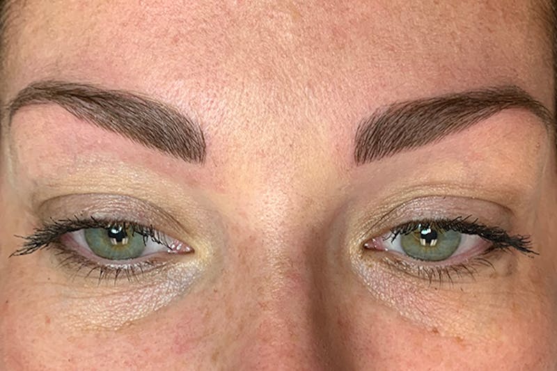 3D Microblading/ Henna Brows Before & After Gallery - Patient 93899727 - Image 6