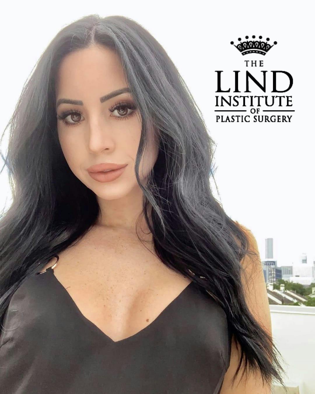 Lind Plastic Surgery patient