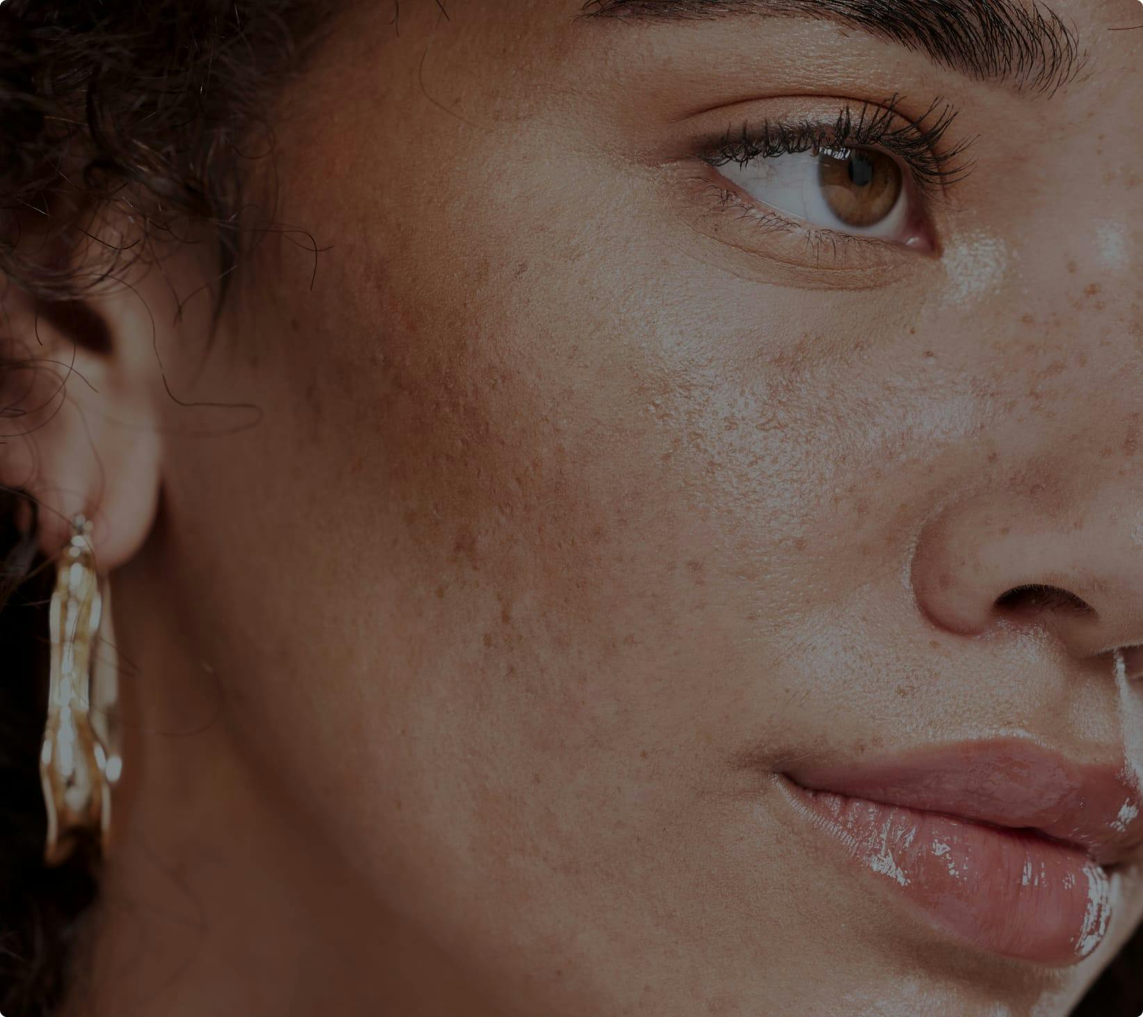 Close up image of womans face with glossy lips and freckles
