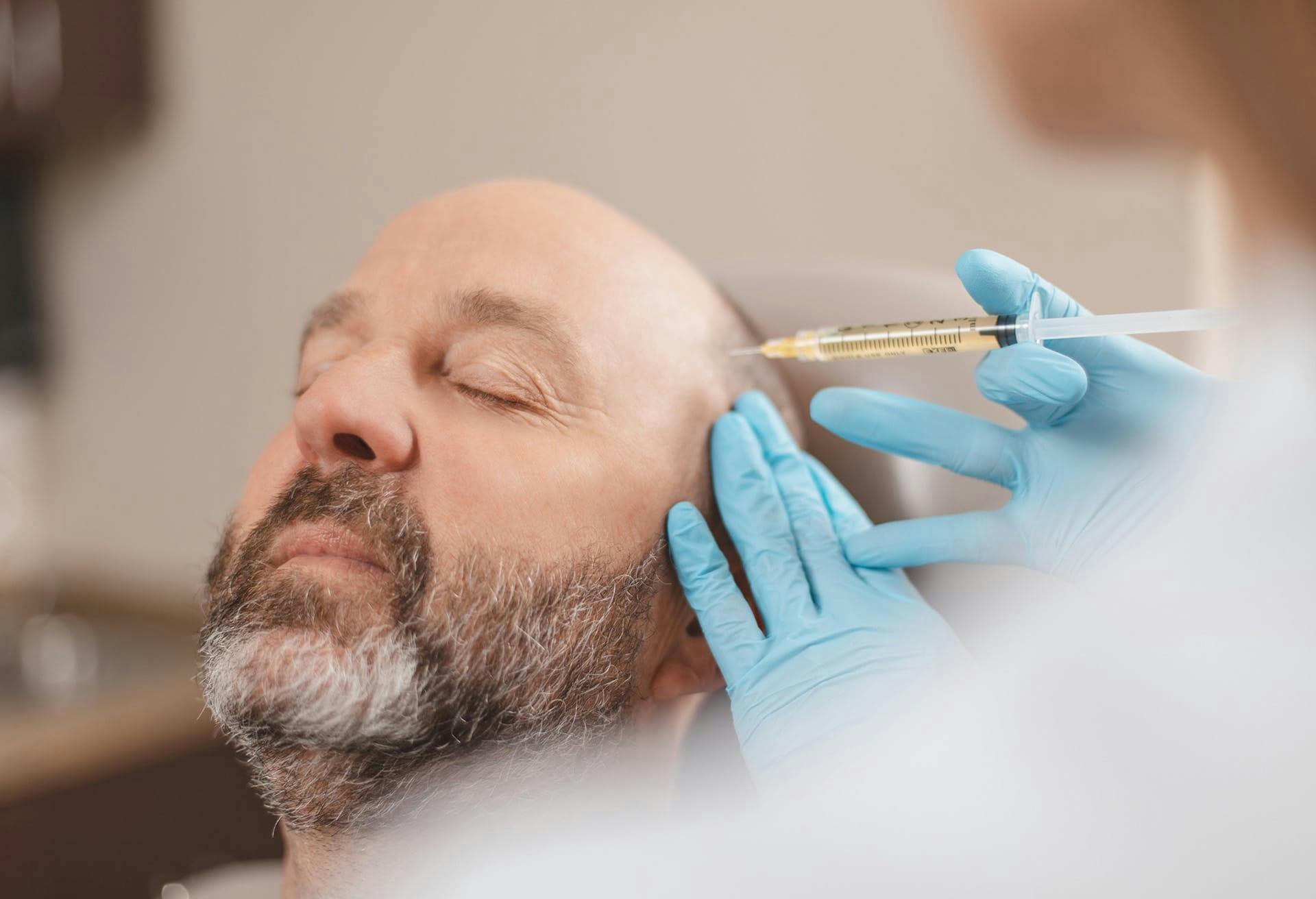 Man getting PRP hair restoration