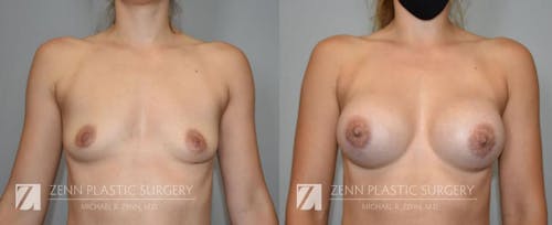 Gallery Before Image