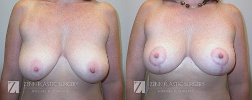 Gallery Before Image