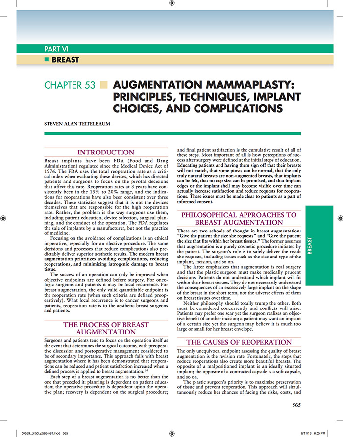 Breast Augmentation article