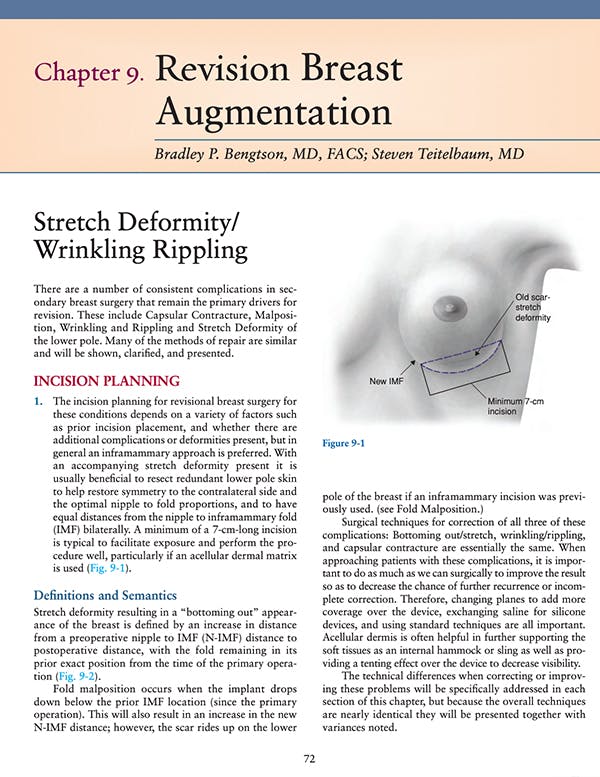 Revision Breast Augmentation Article
