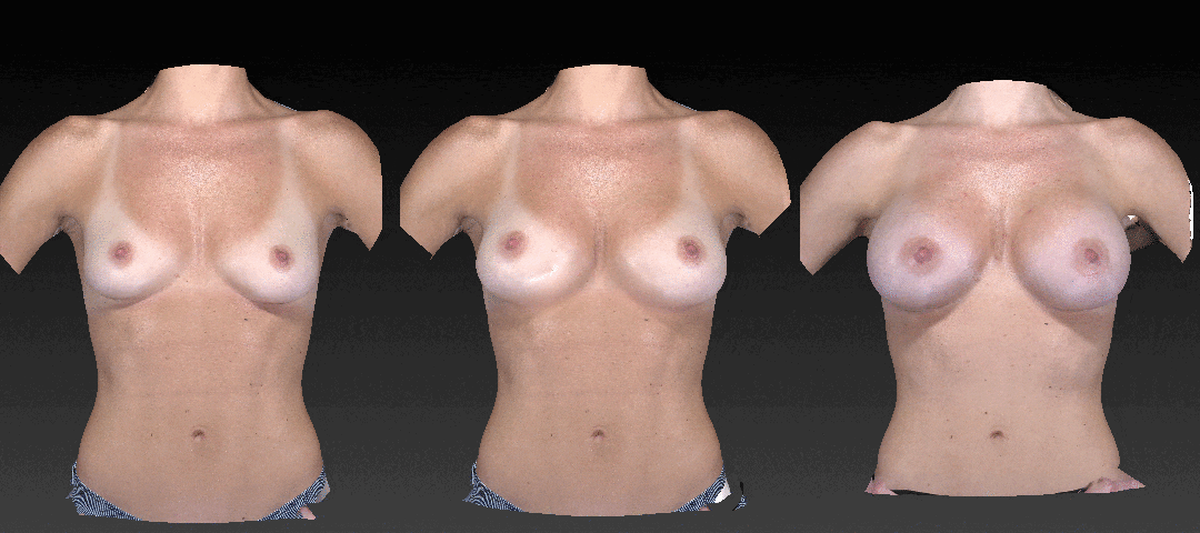 3D Imaging Before & After Gallery - Patient 134859289 - Image 1