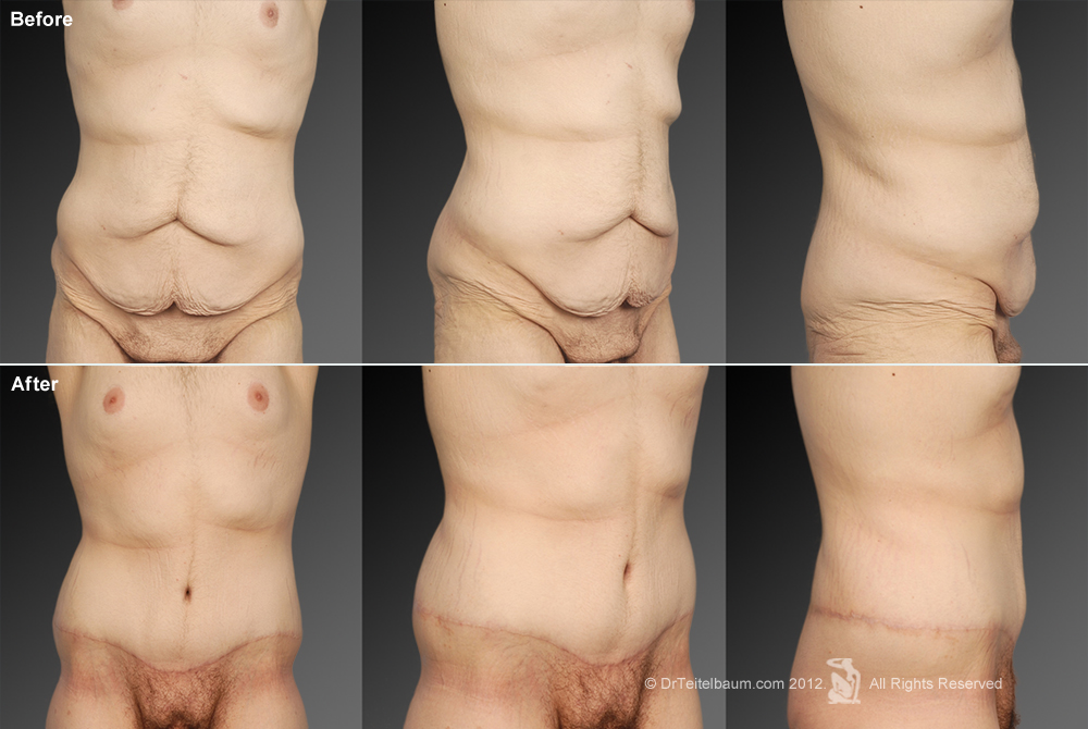 Tummy Buldge Porn