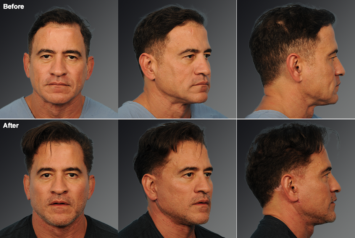 Original 6-panel composite