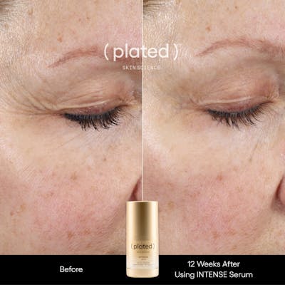 Plated™ Skincare Exosomes Before & After Gallery - Patient 367502 - Image 1