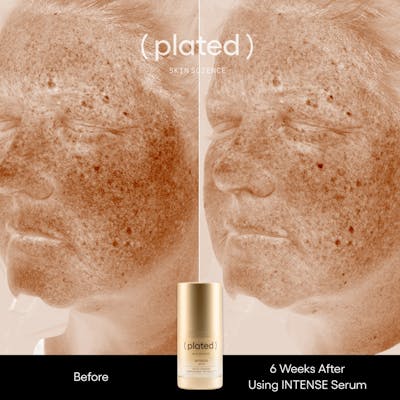 Plated™ Skincare Exosomes Before & After Gallery - Patient 256210 - Image 1