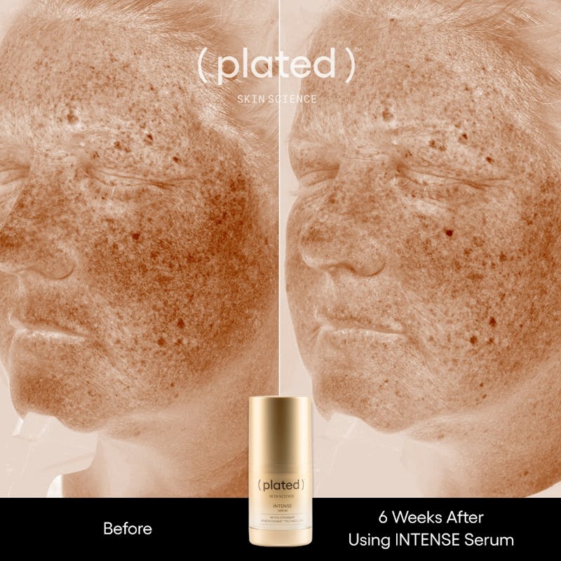 Plated™ Skincare Exosomes Before & After Gallery - Patient 256210 - Image 1