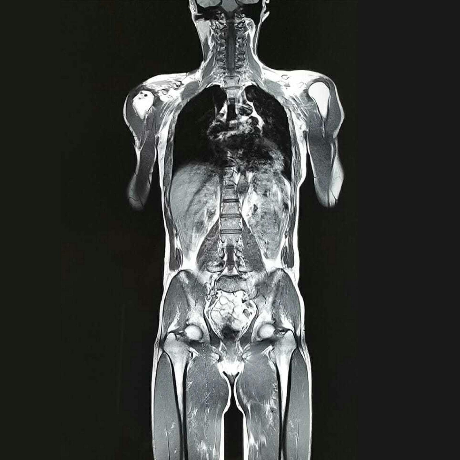Longhorn Imaging Full Body MRI Scan