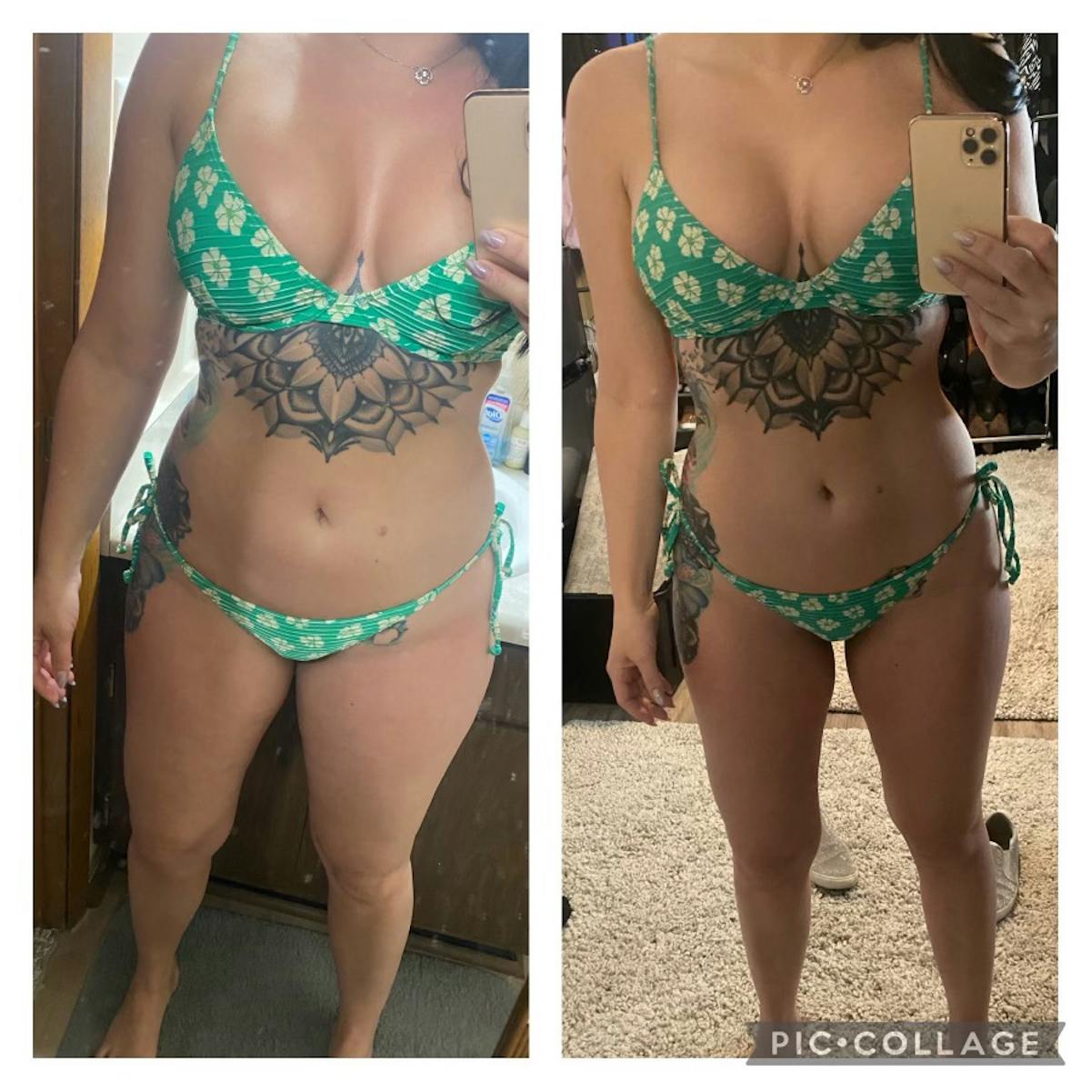 Weight Loss Shots Before & After Gallery - Patient 381179 - Image 1