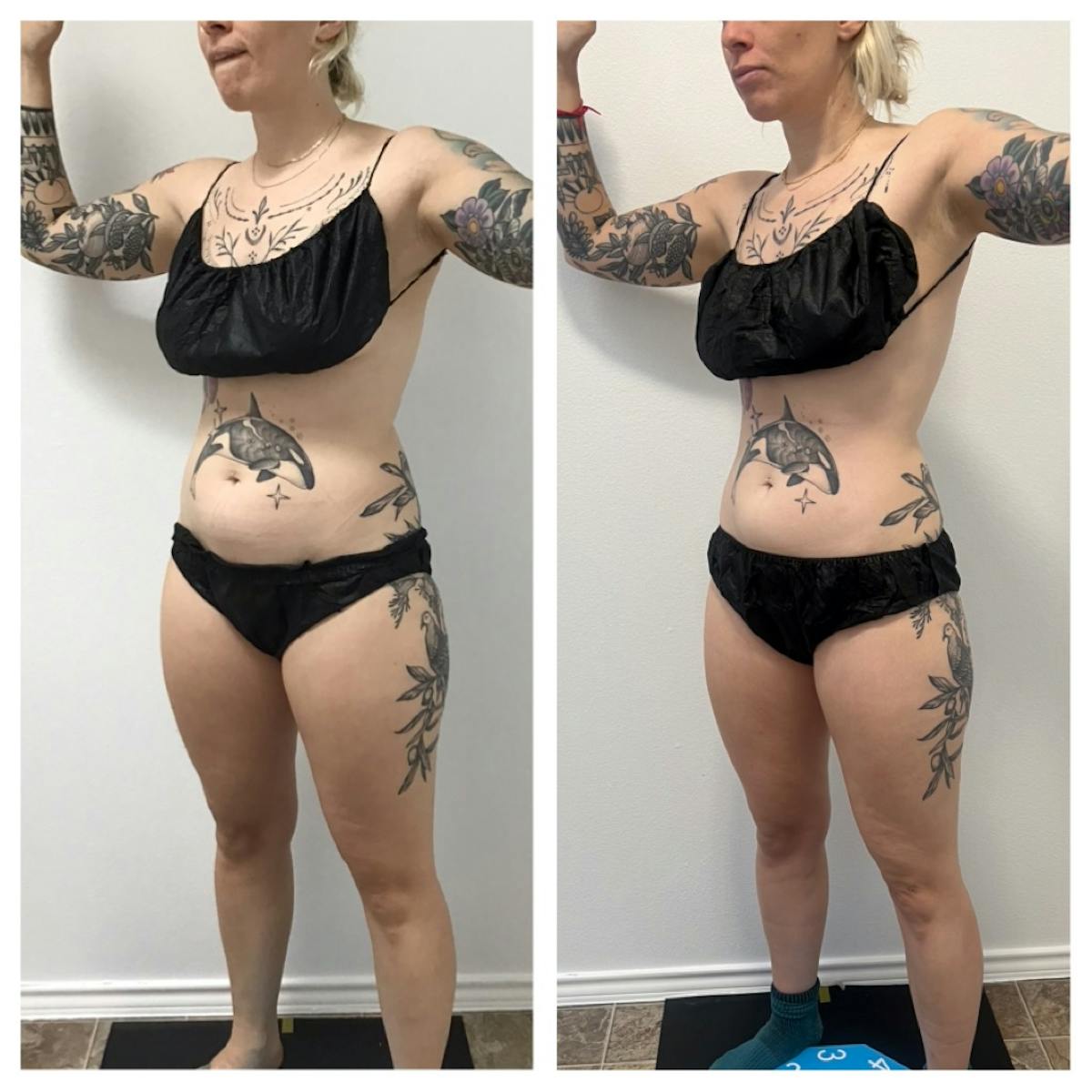 Weight Loss Shots Before & After Gallery - Patient 186758397 - Image 1