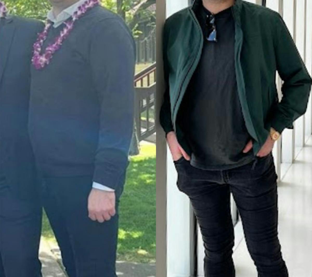 Weight Loss Shots Before & After Gallery - Patient 420894 - Image 1