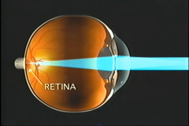 diagram of eyeball