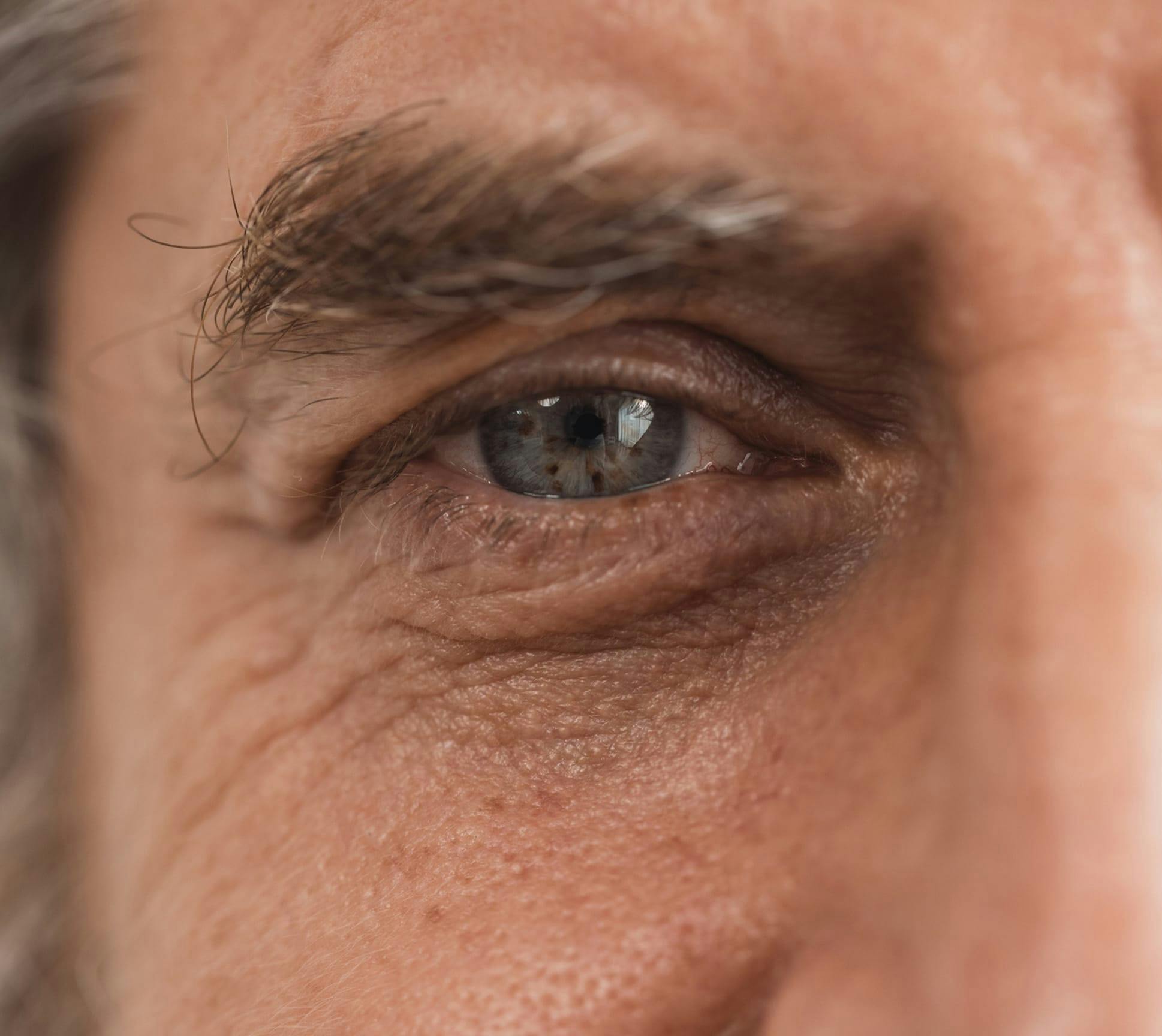 blue grey eye