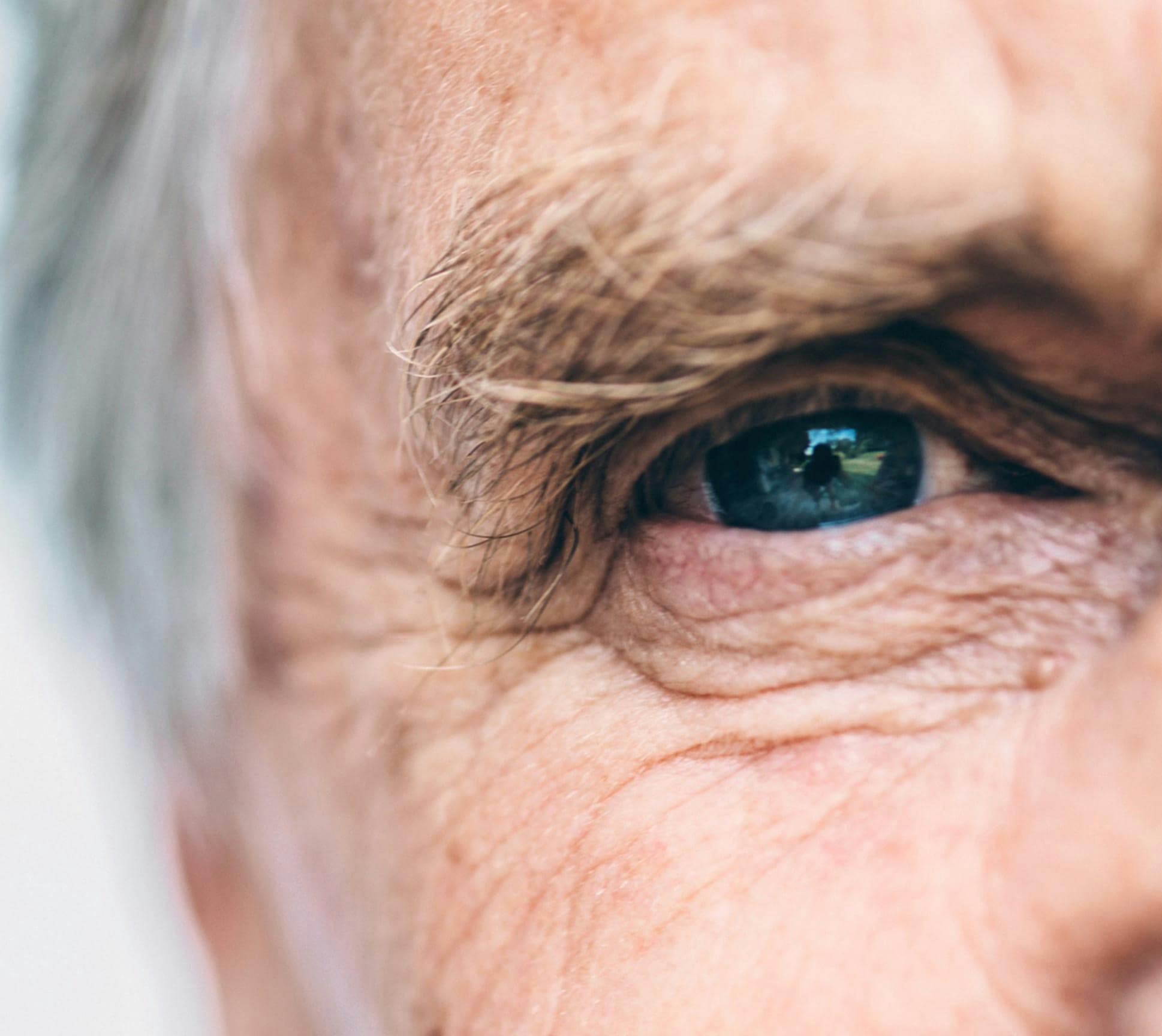 older man's eye