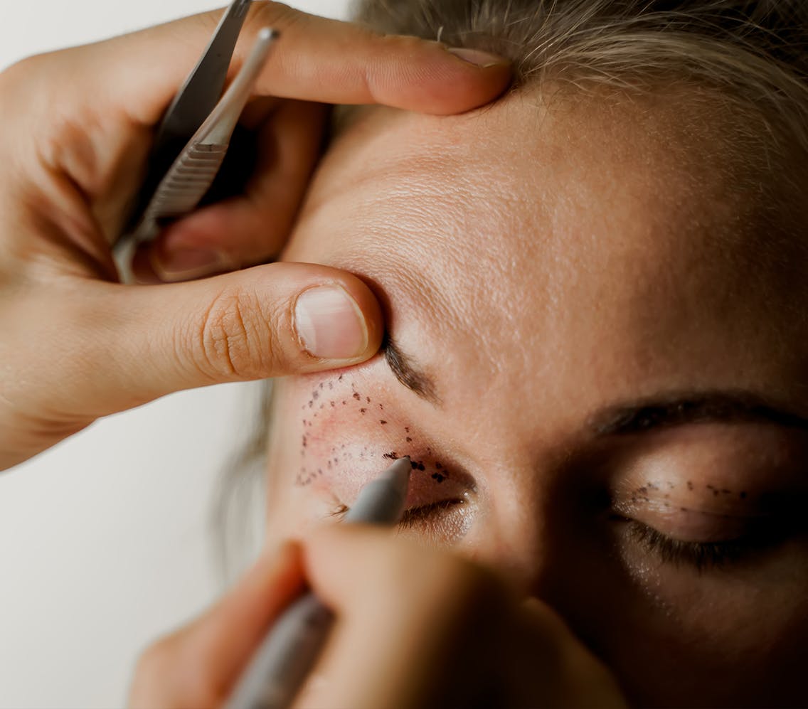 oculoplastic surgery media