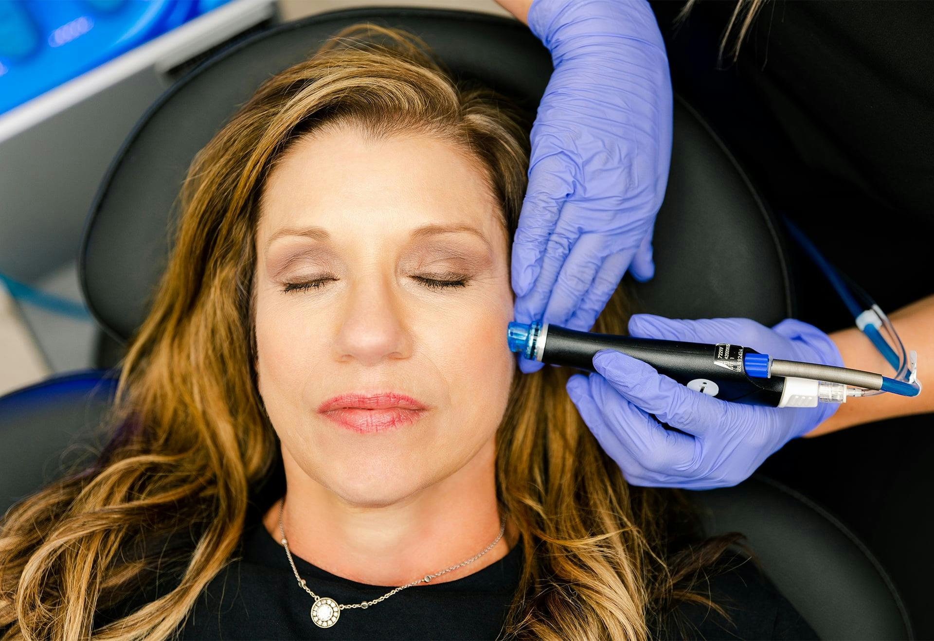 woman getting facial rejuvenation in Tampa