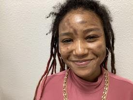 Laser Skin Rejuvenation Before & After Gallery - Patient 158714421 - Image 3