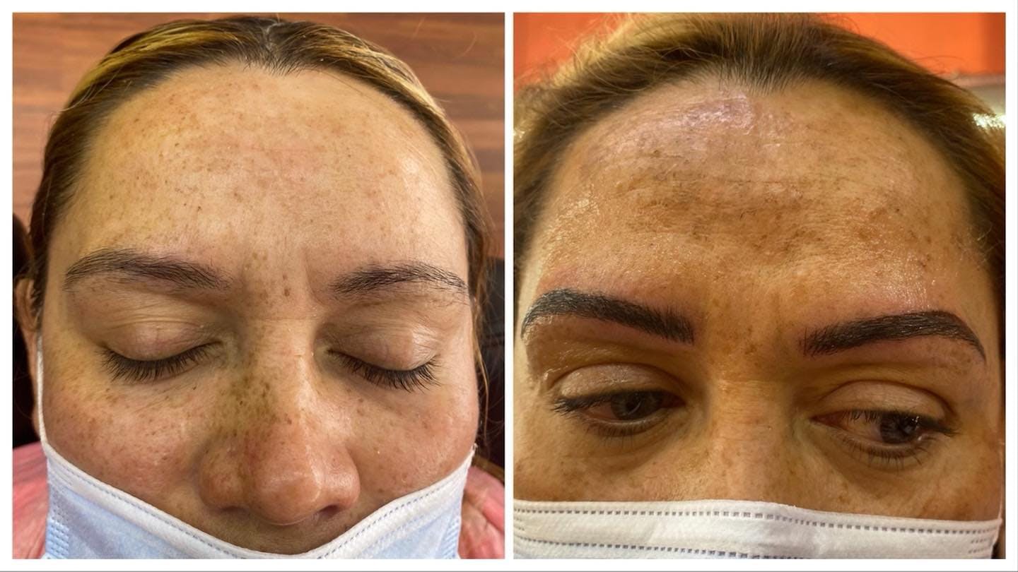 Microblading Before & After Gallery - Patient 195959125 - Image 1