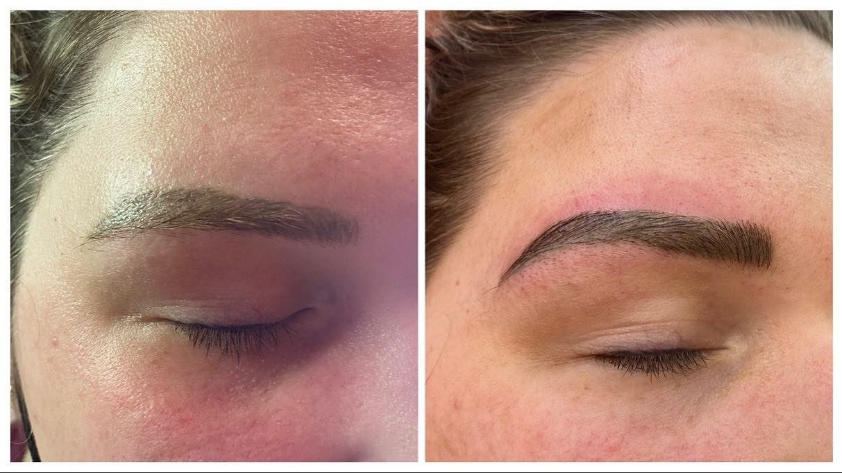 Microblading Before & After Gallery - Patient 239843 - Image 1
