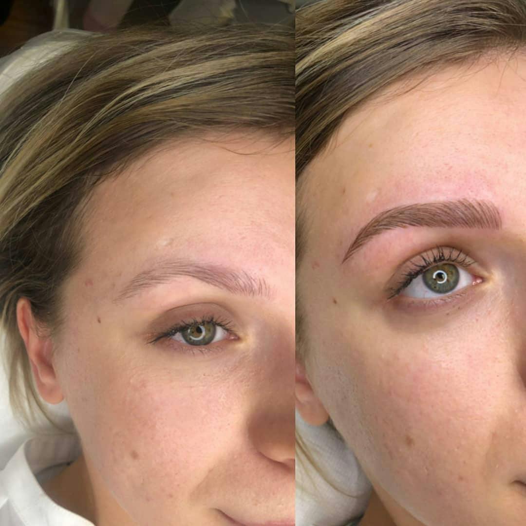 Microblading Before & After Gallery - Patient 195959165 - Image 1