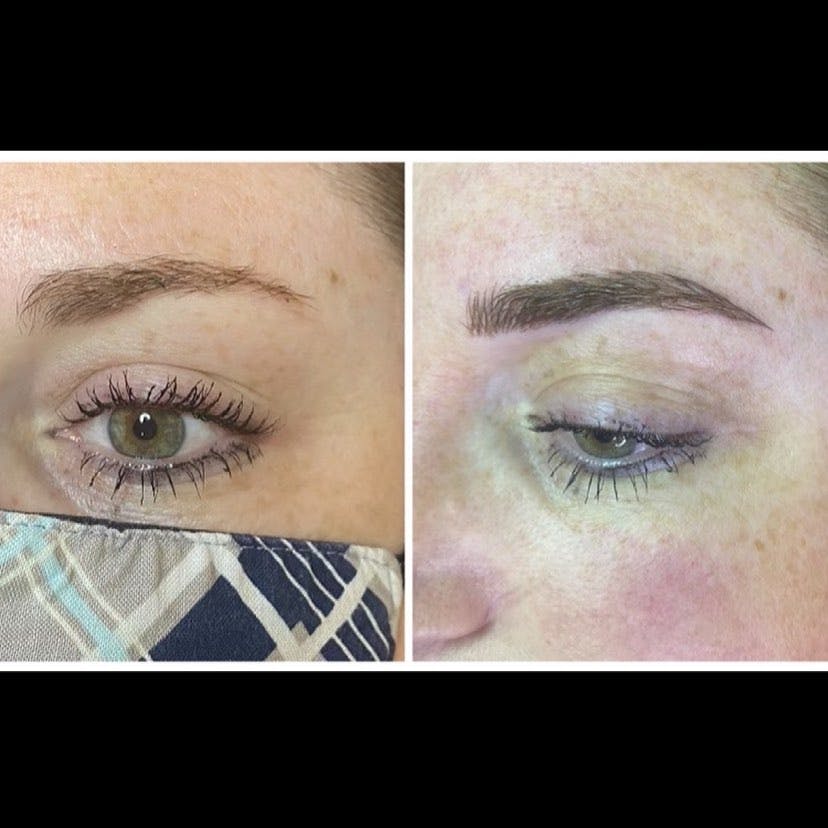 Microblading Before & After Gallery - Patient 195959166 - Image 1
