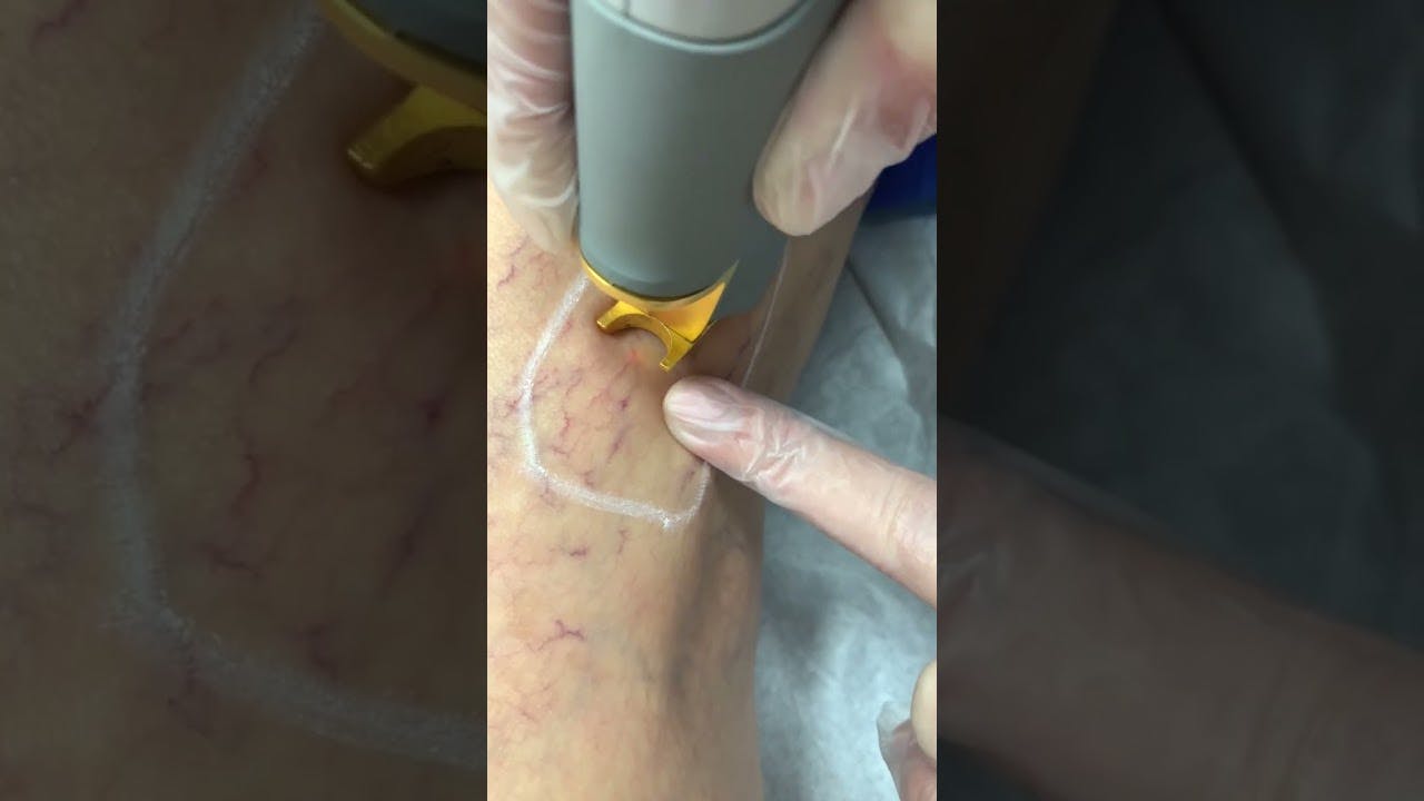 Vein & Aesthetics Center