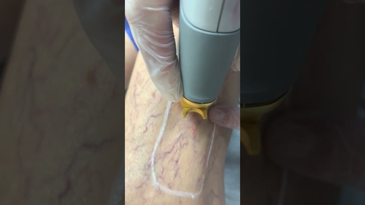 Vein & Aesthetics Center