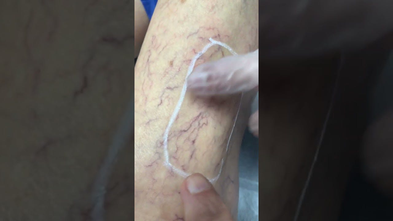 Vein & Aesthetics Center