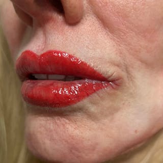 Lip Blushing Before & After Gallery - Patient 483888 - Image 4