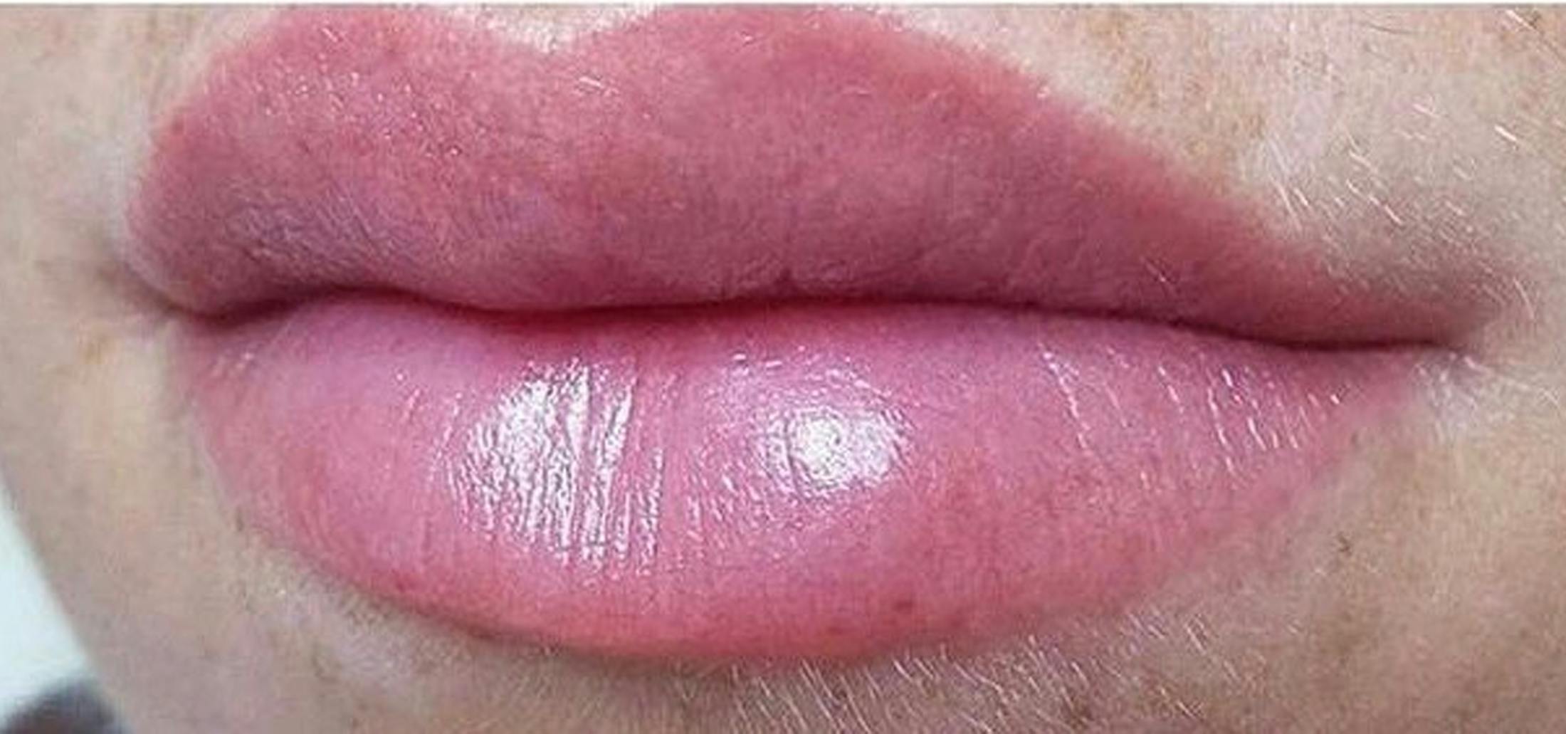 Lip Blushing Before & After Gallery - Patient 240170 - Image 2