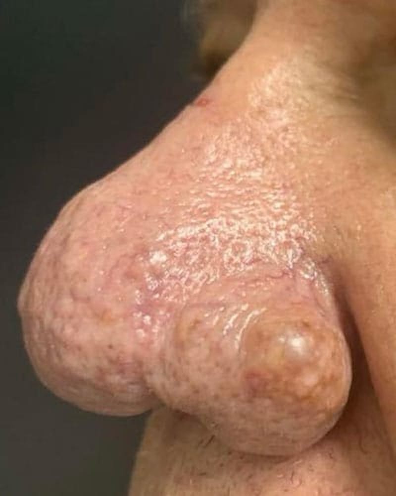 procedure