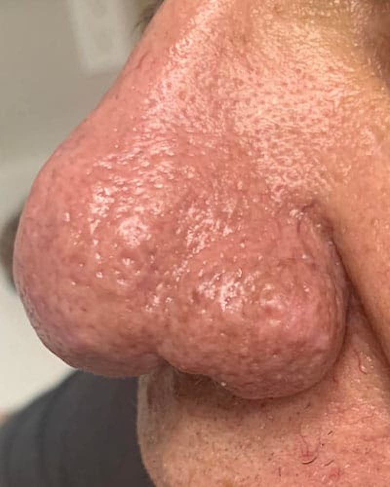 procedure