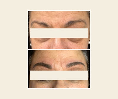 Microblading / Permanent Makeup Before & After Gallery - Patient 195959125 - Image 1