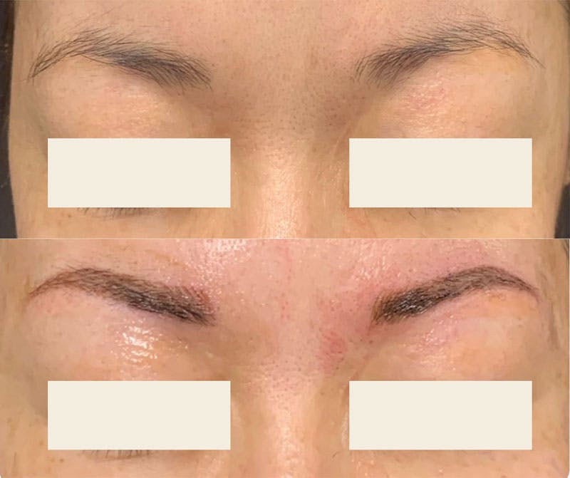 Microblading / Permanent Makeup Before & After Gallery - Patient 128959 - Image 1