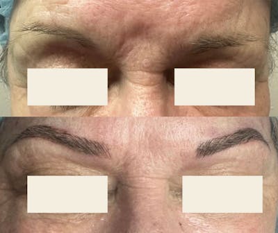 Microblading / Permanent Makeup Before & After Gallery - Patient 384339 - Image 1