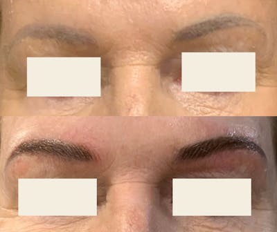 Microblading / Permanent Makeup Before & After Gallery - Patient 284649 - Image 1