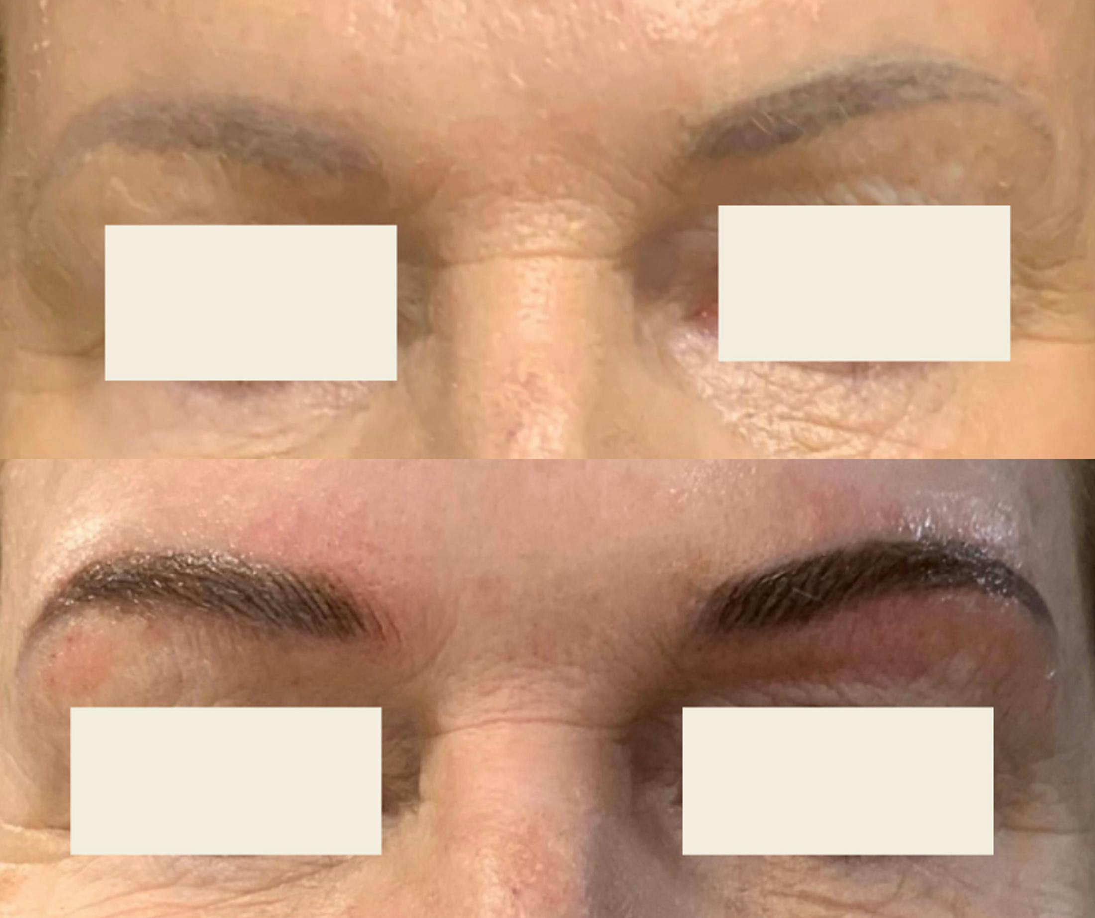 Microblading / Permanent Makeup Before & After Gallery - Patient 204007 - Image 1