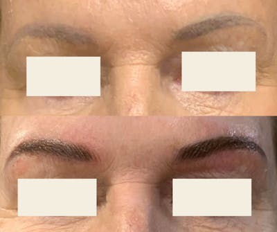 Microblading / Permanent Makeup Before & After Gallery - Patient 204007 - Image 1