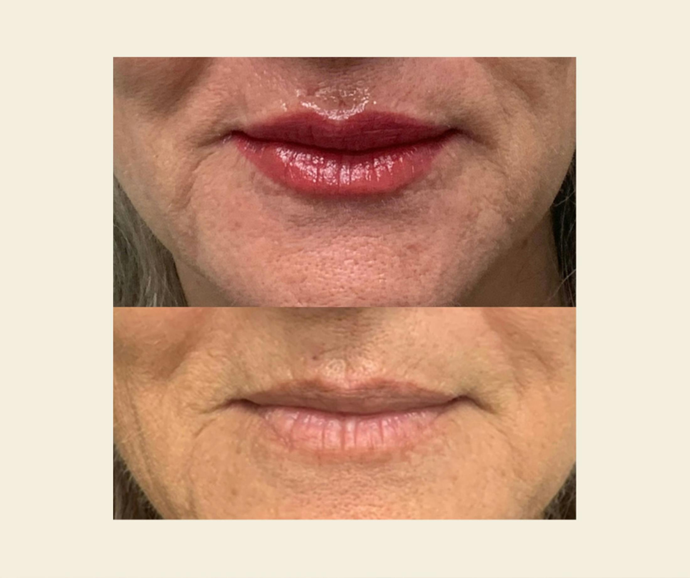 Microblading / Permanent Makeup Before & After Gallery - Patient 145377 - Image 1