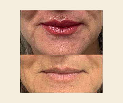 Microblading / Permanent Makeup Before & After Gallery - Patient 145377 - Image 1