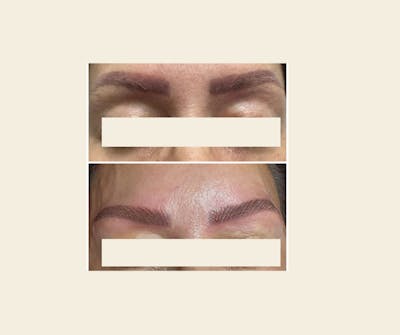 Microblading / Permanent Makeup Before & After Gallery - Patient 174695 - Image 1